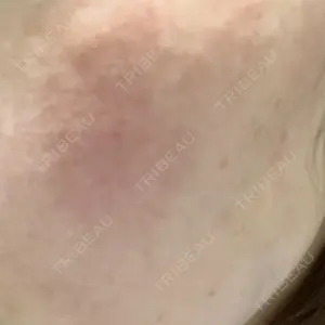 エースクリニック 大阪梅田HEPナビオ院口コミ