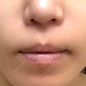 B-LINE CLINIC 池袋院口コミ