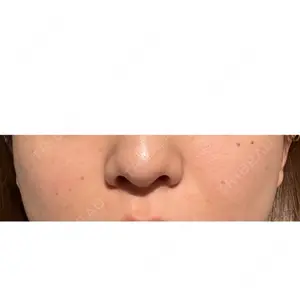 HAAB×DREAM BEAUTY CLINIC 東京本院口コミ