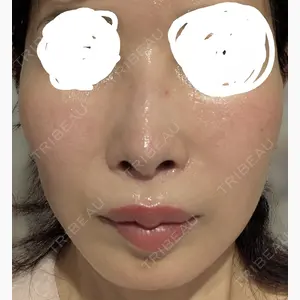 FACE SKIN CLINIC口コミ