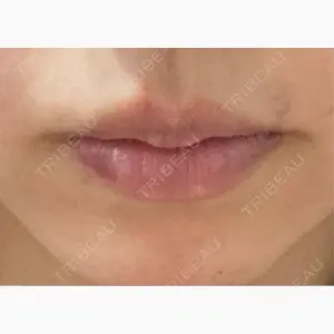 HAAB×DREAM BEAUTY CLINIC 大阪梅田院口コミ