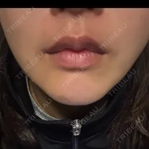 湘南美容クリニック 大阪梅田本院口コミ