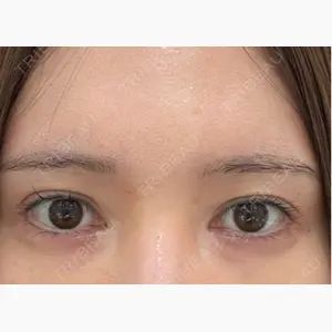 BIANCA銀座口コミ