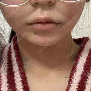 新宿美容外科ネビュラクリニック口コミ