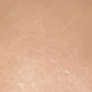 吉祥寺アイビークリニック口コミ