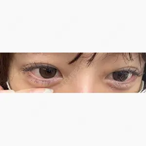 ルラ美容クリニック 上野院口コミ