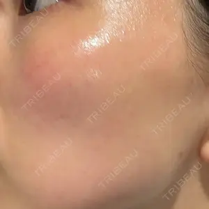 AURORA CLINIC（オーロラクリニック）新宿院口コミ