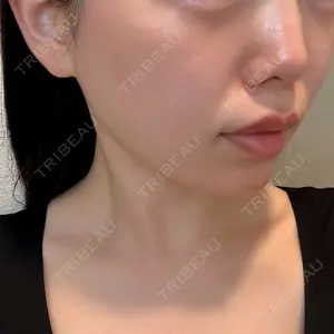 ライズワン美容皮膚科クリニック口コミ