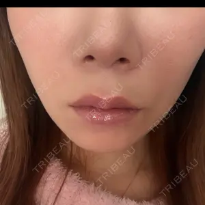 ルラ美容クリニック 上野院口コミ