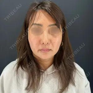 HAAB×DREAM BEAUTY CLINIC 大阪梅田院口コミ