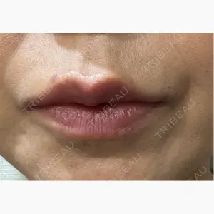 吉祥寺アイビークリニック口コミ