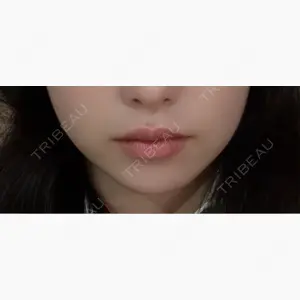 TCB東京中央美容外科 京都駅前院口コミ