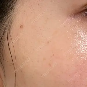 ルラ美容クリニック 仙台院 / ルラスキンクリニック 仙台院口コミ