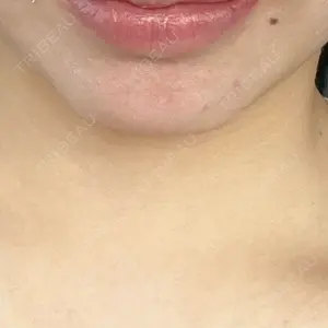 ルラ美容クリニック 四国・高松院口コミ