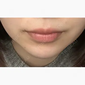 PRO CLINIC プロクリニック 銀座院口コミ