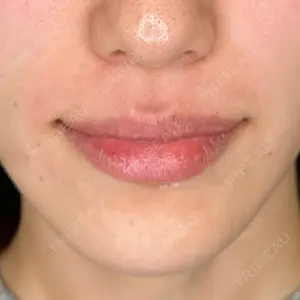 ルラ美容クリニック 静岡院口コミ