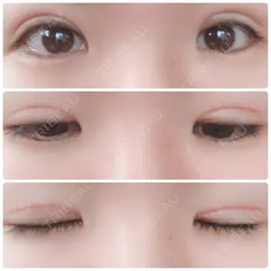 みやざき美容クリニック口コミ