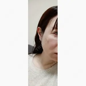 AZ BEAUTY CLINIC口コミ