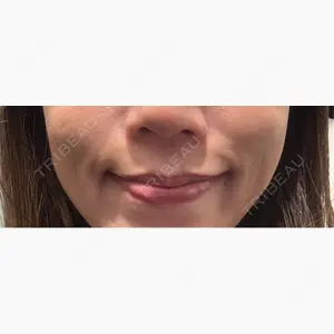 Wi Clinic （ウィ クリニック）心斎橋院口コミ