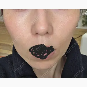 フィラークリニック 福岡院口コミ