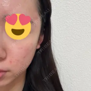 梅田すずらんクリニック口コミ