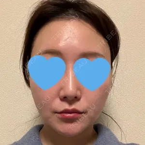 下北沢スキンクリニック口コミ