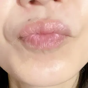 ルラ美容クリニック 静岡院口コミ