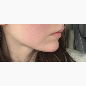 ルラ美容クリニック 京都院口コミ