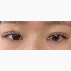 HAAB BEAUTY CLINIC 名古屋院口コミ