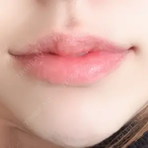 ルラ美容クリニック 名古屋本院口コミ