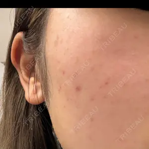 ルラ美容クリニック 福岡天神院口コミ