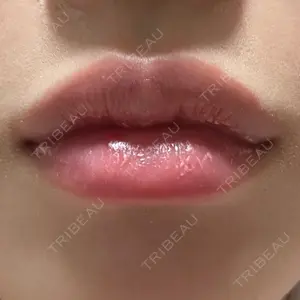 ルラ美容クリニック 大阪本院口コミ