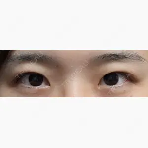 蘇春堂形成外科口コミ