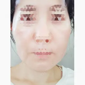 東京形成美容外科 船橋院口コミ