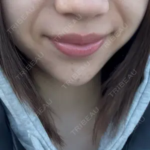 ルラ美容クリニック 大阪本院口コミ