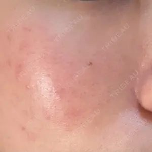 ルラ美容クリニック 大阪心斎橋院口コミ