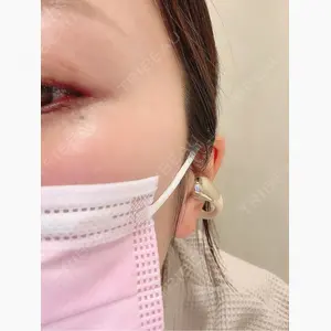 Leap beauty clinic口コミ