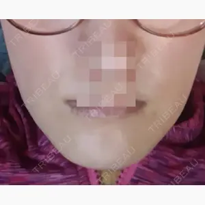 高崎TAクリニック口コミ