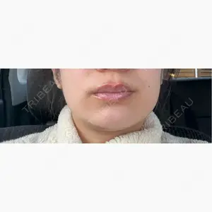 RIVER CLINIC（リバークリニック）口コミ