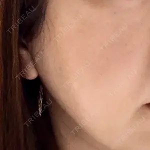 小倉美容外科/美容皮膚科 ビラビューティークリニック口コミ