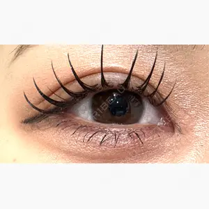 フィラークリニック 福岡院口コミ