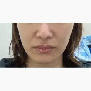 博多美容外科/美容皮膚科 ビラビューティークリニック口コミ