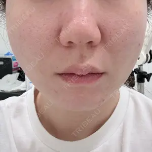 TCB東京中央美容外科 金山院口コミ