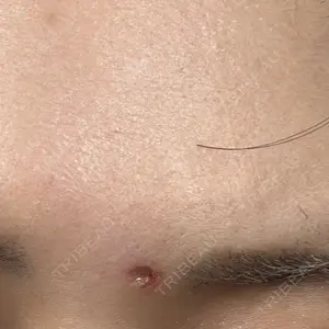 ルラ美容クリニック 大阪本院口コミ