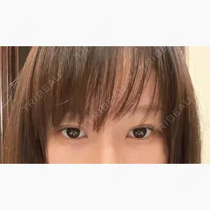 APOLLO BEAUTY CLINIC口コミ