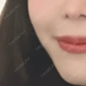 MKクリニック 日本橋院口コミ