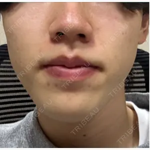 APスキンクリニック銀座口コミ