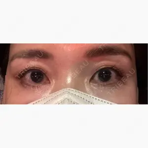 APスキンクリニック銀座口コミ