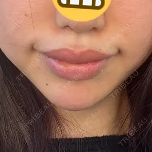 アネシス美容クリニック口コミ