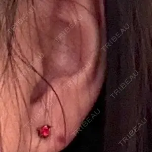 新宿ラクル美容外科クリニック 六本木院口コミ